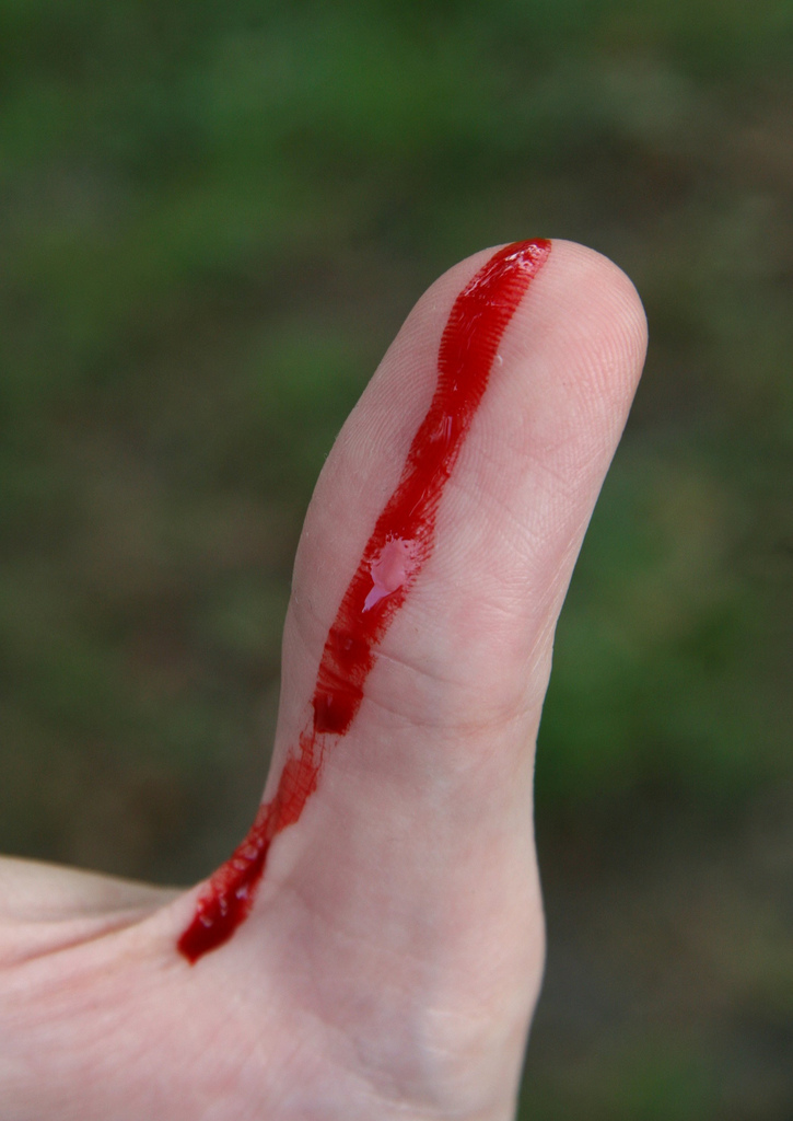 en la imagen que se ve de sangre en el dedo